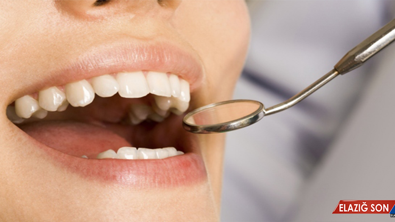 Diş çürüklerinden korunmak için doğru beslenme önemli