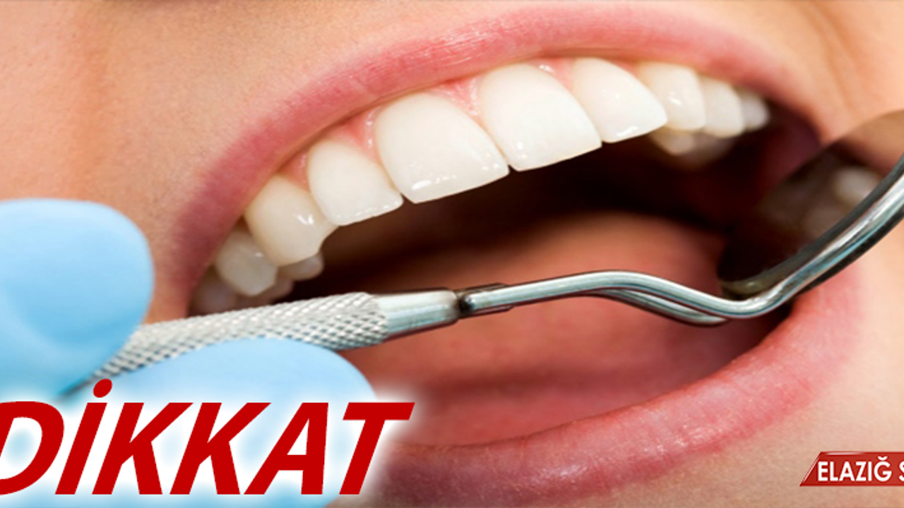 İmplant yaptıracakların dikkat etmesi gereken önemli noktalar