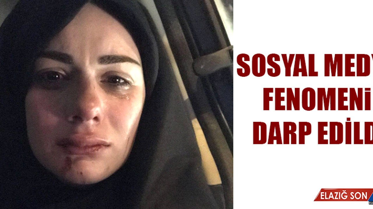 Sosyal Medya Fenomeni Elif Kübra Genç, Darp Edildi