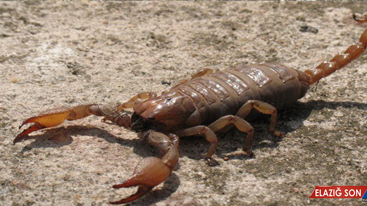Şarkıcı İntizar akrep soktuktan sonra yeşil olan gözlerinin koyulaştığını söylemişti! İşte uzman yorumu...