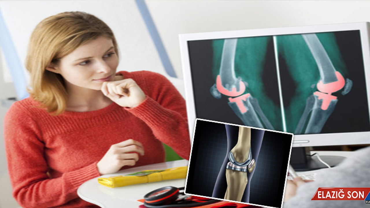 DİZ PROTEZİ ÖMÜRLÜK BİR AMELİYAT MIDIR?
