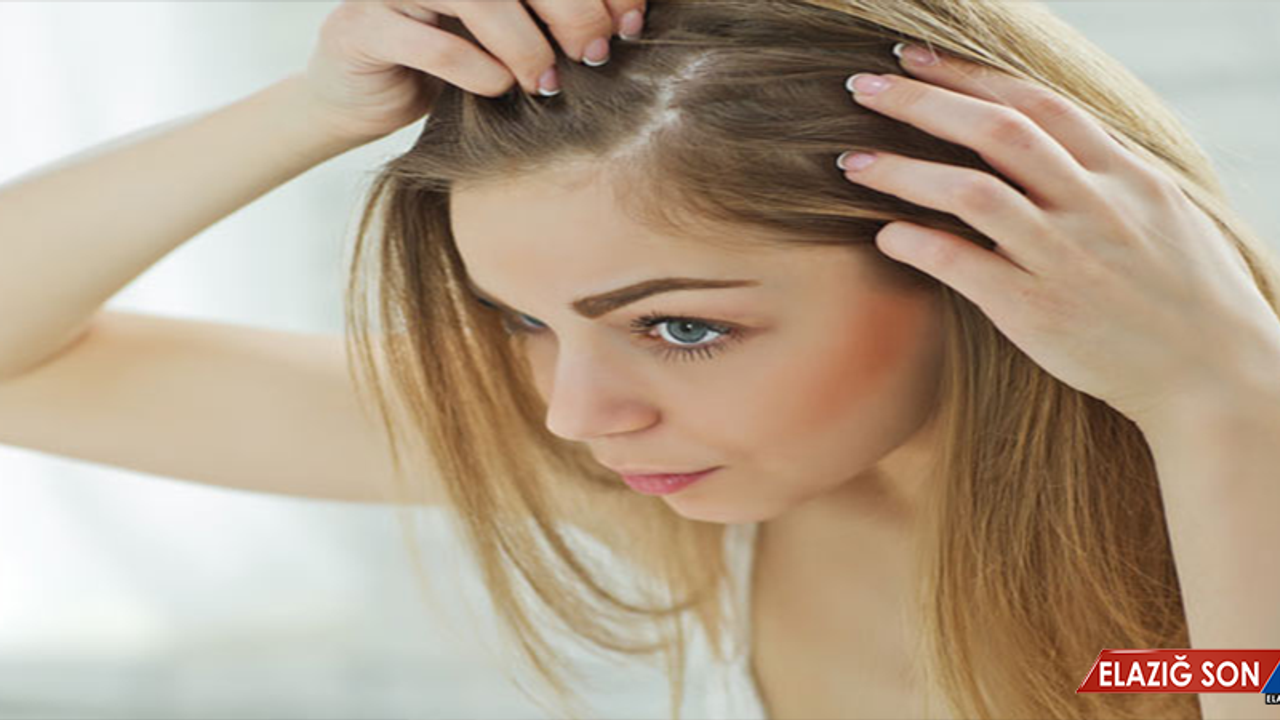 “Saçı Yağlı Olanlar Yağ İçeren Şampuan Kullanmamalı”