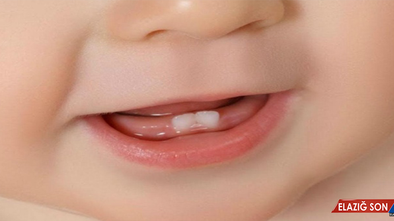 Süt Dişlerinin Çürüyüp Erken Çekilmesi Halinde Ne Yapılması Gerekir?