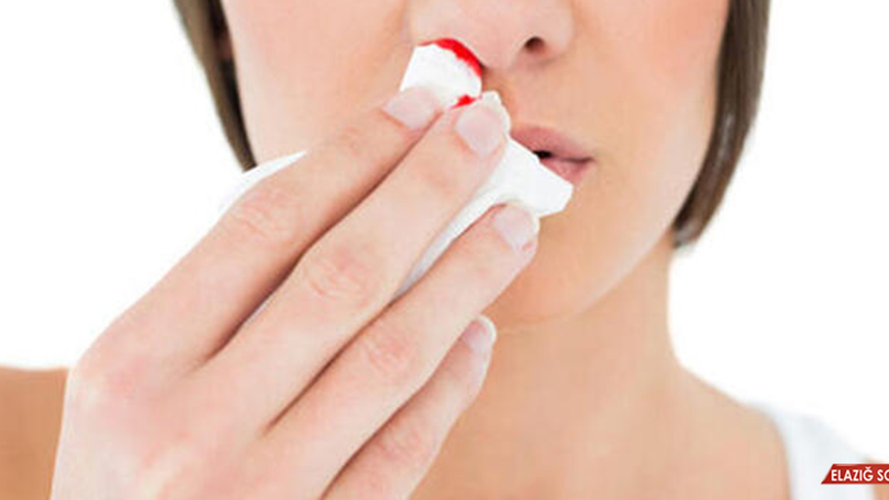 Burun Kanamasına Ne İyi Gelir, Nasıl Geçer? Burun Kanaması Nasıl Durdurulur?