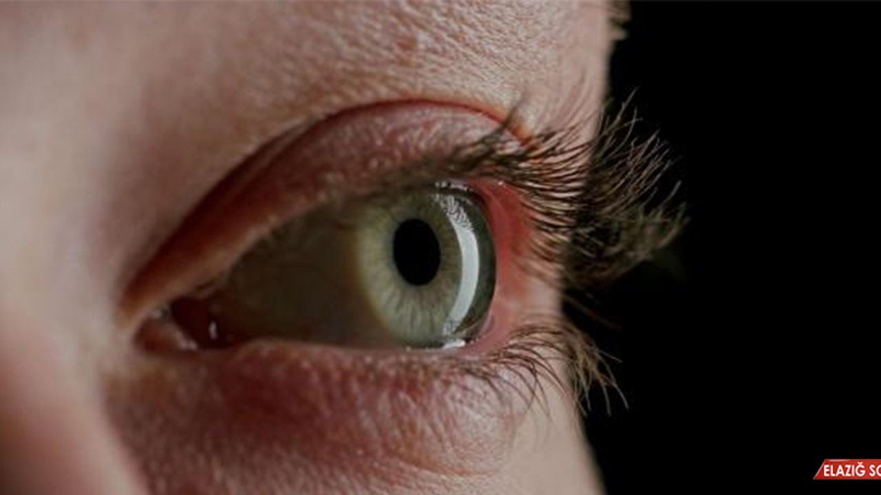 Akıllı Mercek Ameliyatı Herkese Önerilmiyor