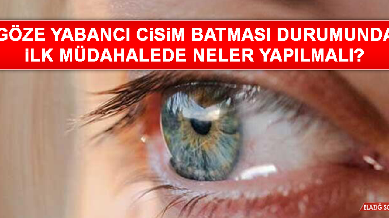 Göze yabancı cisim batması durumunda ilk müdahalede neler yapılmalı?