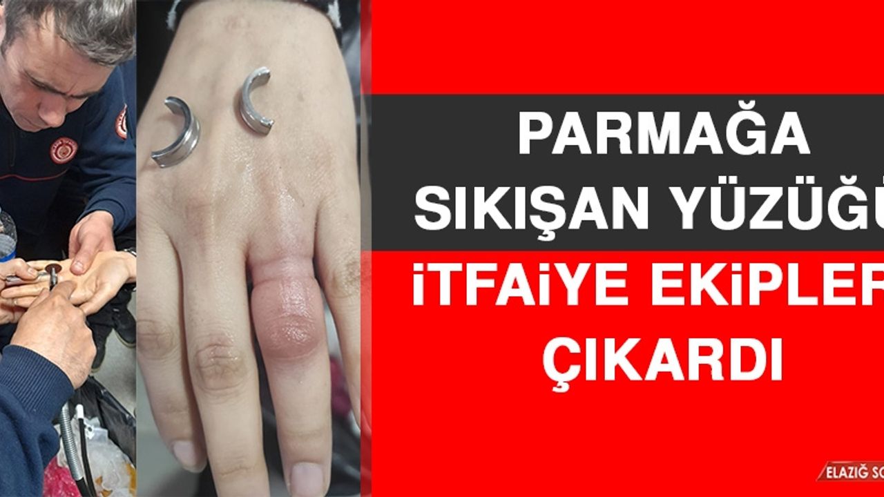 Parmağa Sıkışan Yüzüğü İtfaiye Ekipleri Çıkardı