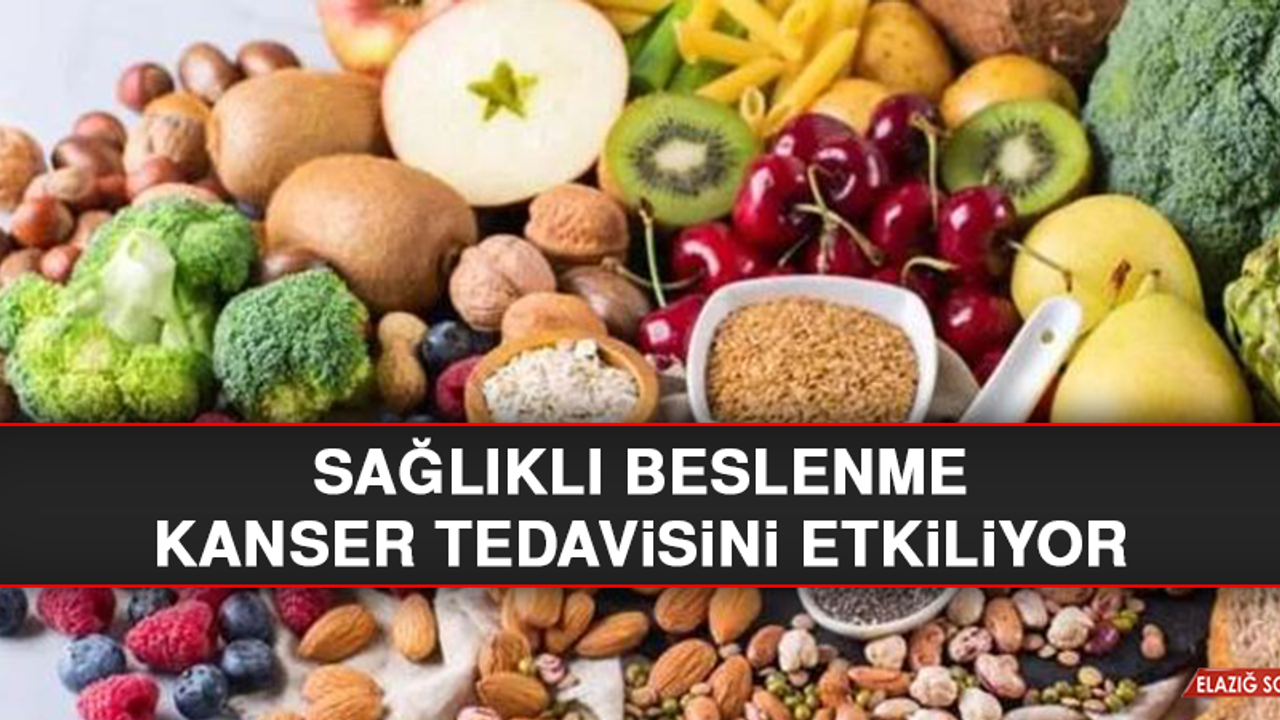 Sağlıklı Beslenme Kanser Tedavisini Etkiliyor