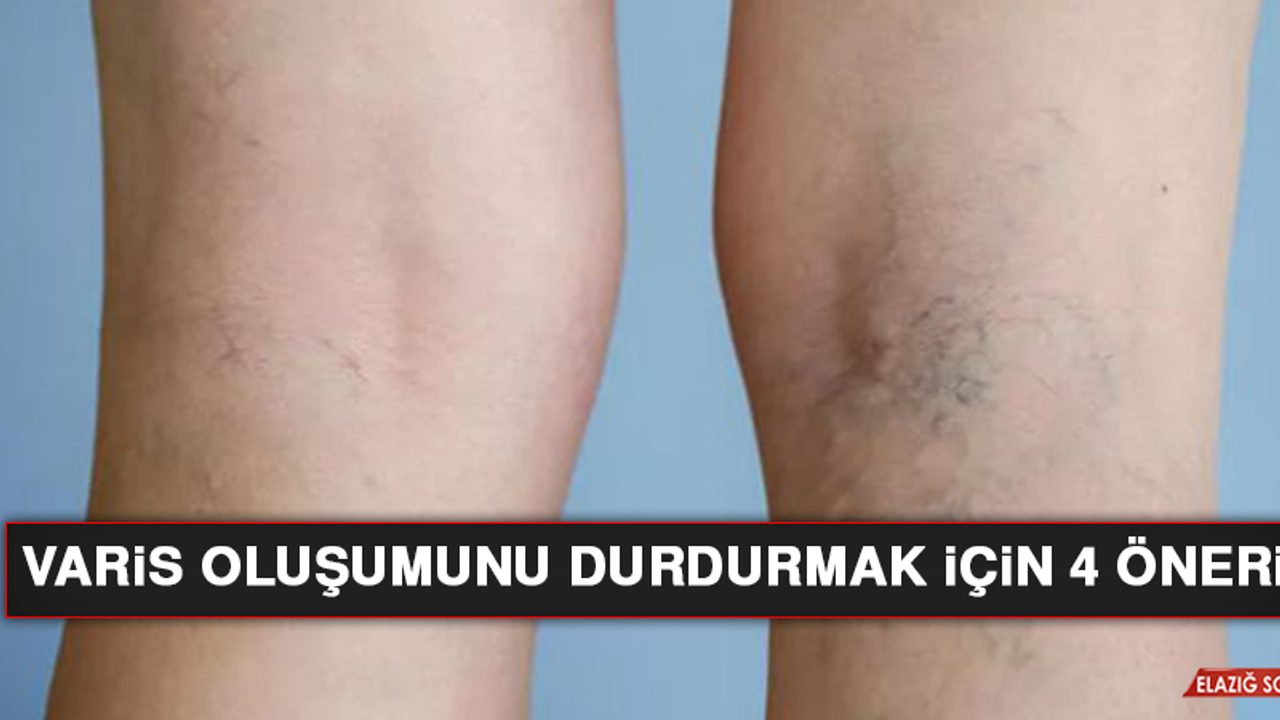 Varis Oluşumunu Durdurmak İçin 4 Öneri