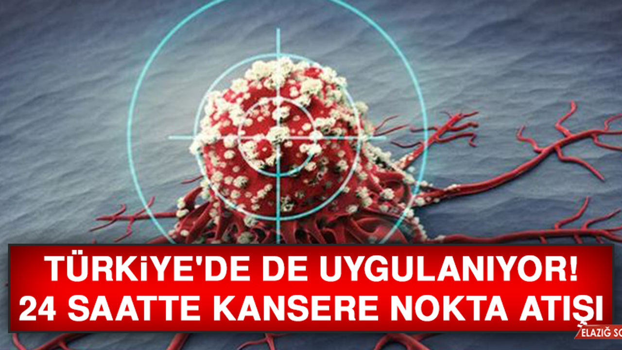 Türkiye'de de uygulanıyor! 24 saatte kansere nokta atışı