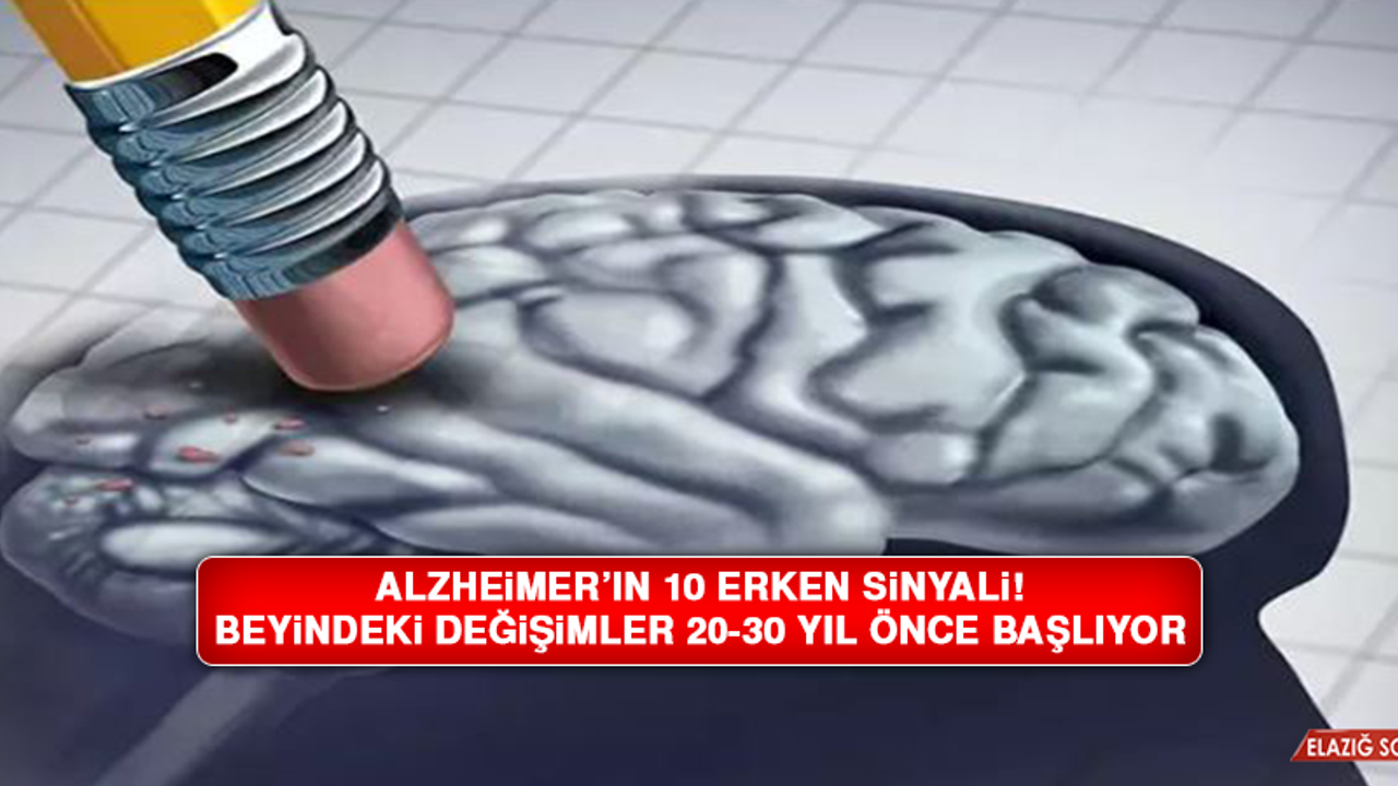 Alzheimer’ın 10 erken sinyali! Beyindeki değişimler 20-30 yıl önce başlıyor