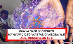 Dünya Sağlık Örgütü Maymun Çiçeği Hastalığı Nedeniyle Acil Durum İlan Etti