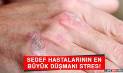 Sedef Hastalarının En Büyük Düşmanı Stres!