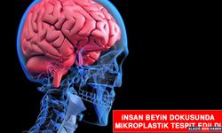 İnsan Beyin Dokusunda Mikroplastik Tespit Edildi