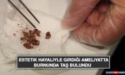 Estetik Hayaliyle Girdiği Ameliyatta Burnunda Taş Bulundu