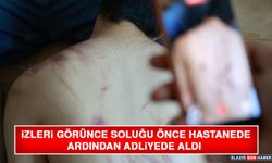 İzleri Görünce Soluğu Önce Hastanede Ardından Adliyede Aldı