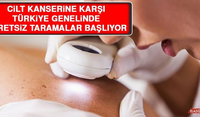 Cilt Kanserine Karşı Türkiye Genelinde Ücretsiz Taramalar Başlıyor