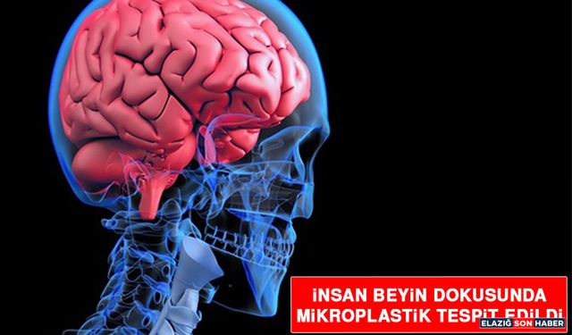 İnsan Beyin Dokusunda Mikroplastik Tespit Edildi