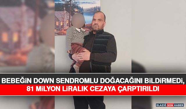 Bebeğin Down Sendromlu Doğacağını Bildirmedi, 81 Milyon Liralık Cezaya Çarptırıldı