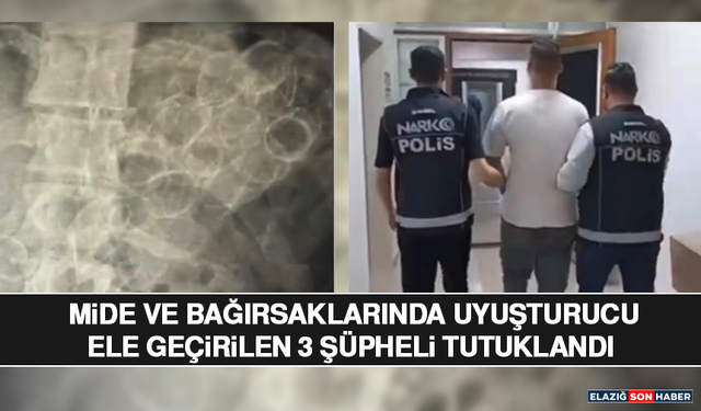 Mide ve bağırsaklarında uyuşturucu ele geçirilen 3 şüpheli tutuklandı