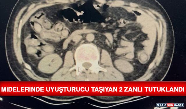 Midelerinde Uyuşturucu Taşıyan 2 Zanlı Tutuklandı
