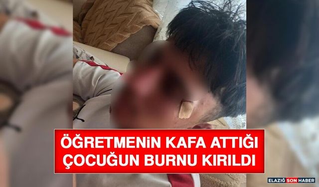 Öğretmenin Kafa Attığı Çocuğun Burnu Kırıldı