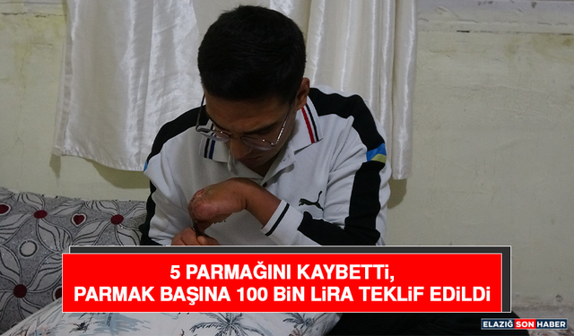5 Parmağını Kaybetti, Parmak Başına 100 Bin Lira Teklif Edildi
