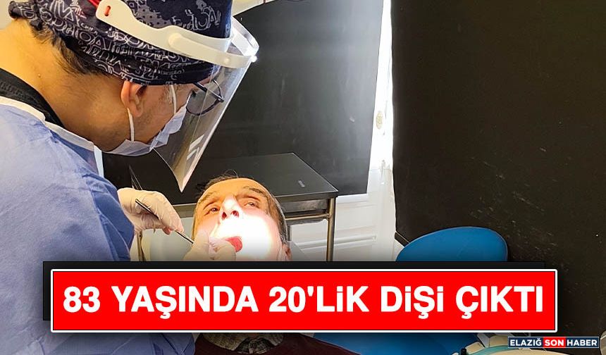 83 Yaşında 20'lik Dişi Çıktı
