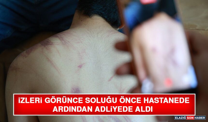 İzleri Görünce Soluğu Önce Hastanede Ardından Adliyede Aldı