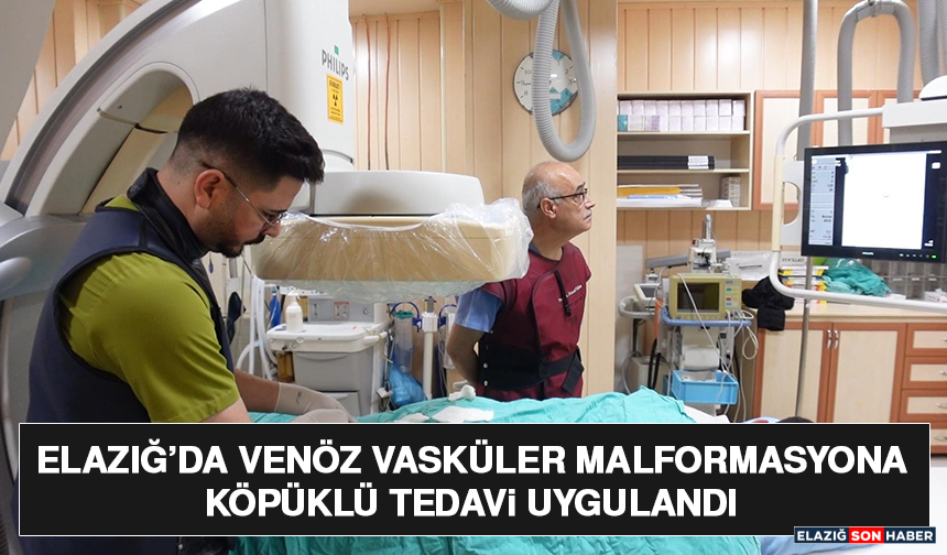 Elazığ’da Venöz Vasküler Malformasyona Köpüklü Tedavi Uygulandı