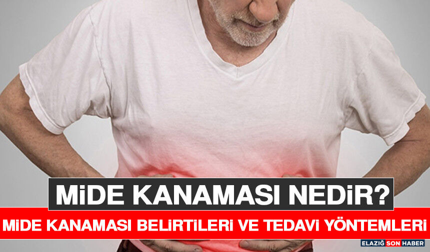 Mide Kanaması Nedir? Mide Kanaması Belirtileri ve Tedavi Yöntemleri