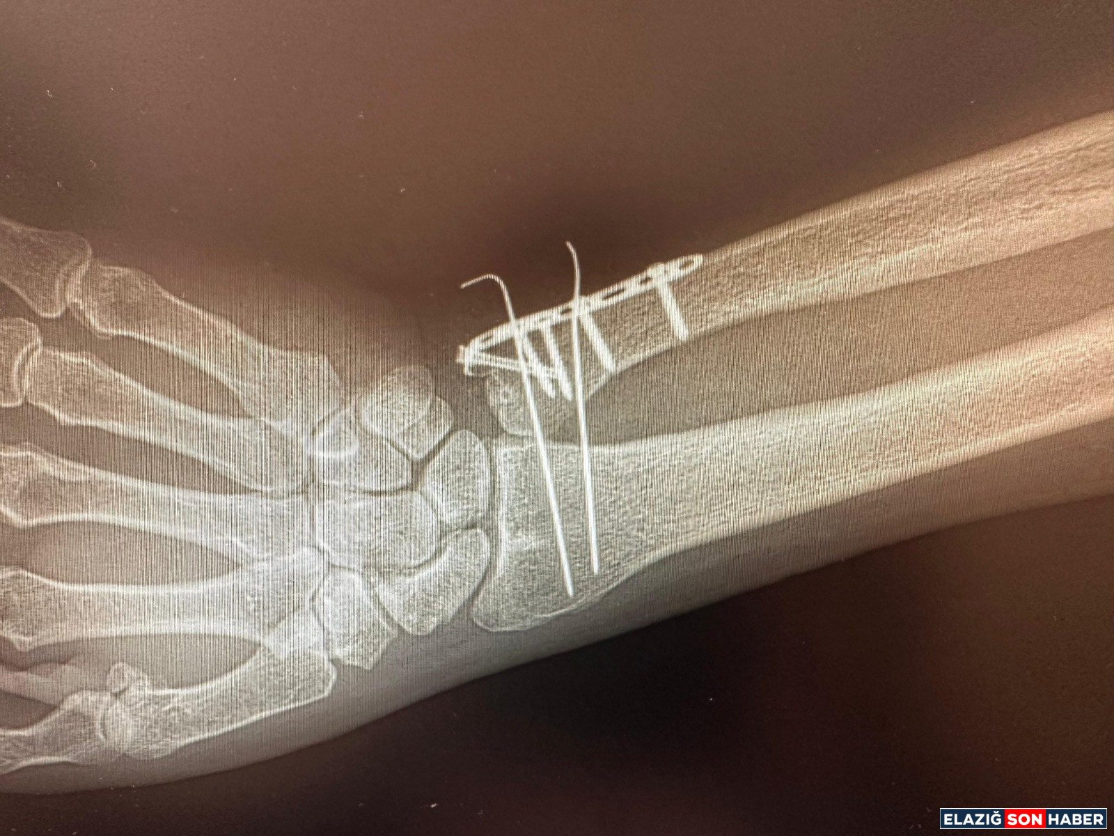 Whatsapp Image 2026 04 16 At 10.52.56