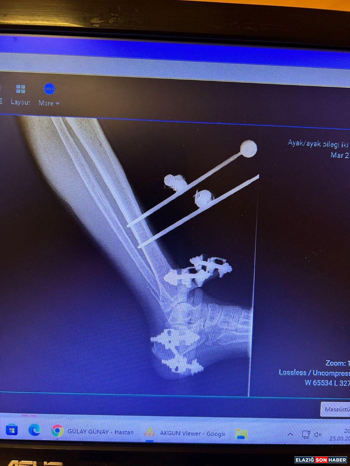 Whatsapp Image 2026 04 16 At 10.52.57-1